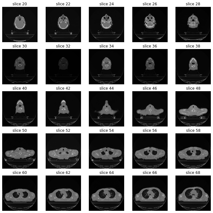 DICOM Data